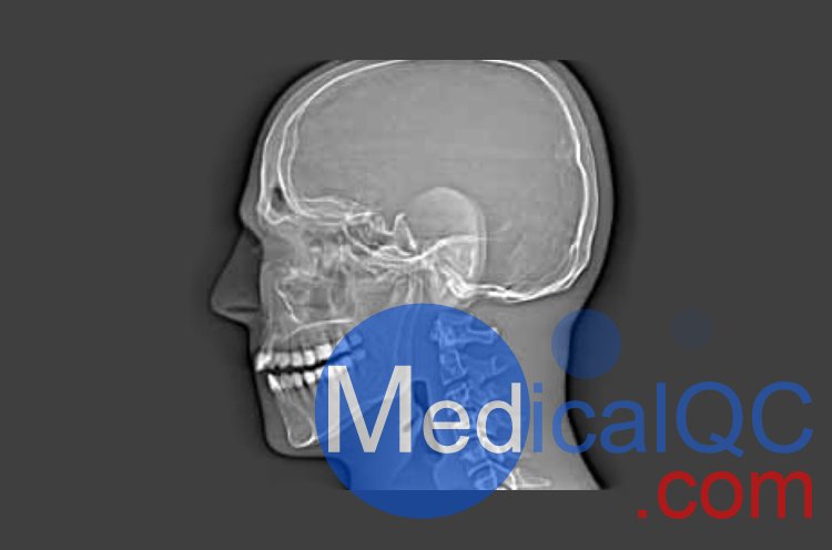 CIRS 711-HN頭部模體，CIRS 711-HN CBCT模體