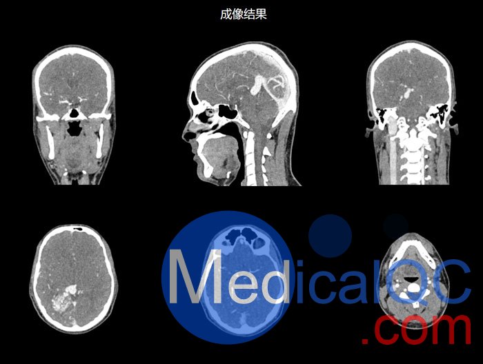 NLP1000頭頸模體，NLP1000頭部模體，NLP1000頭模