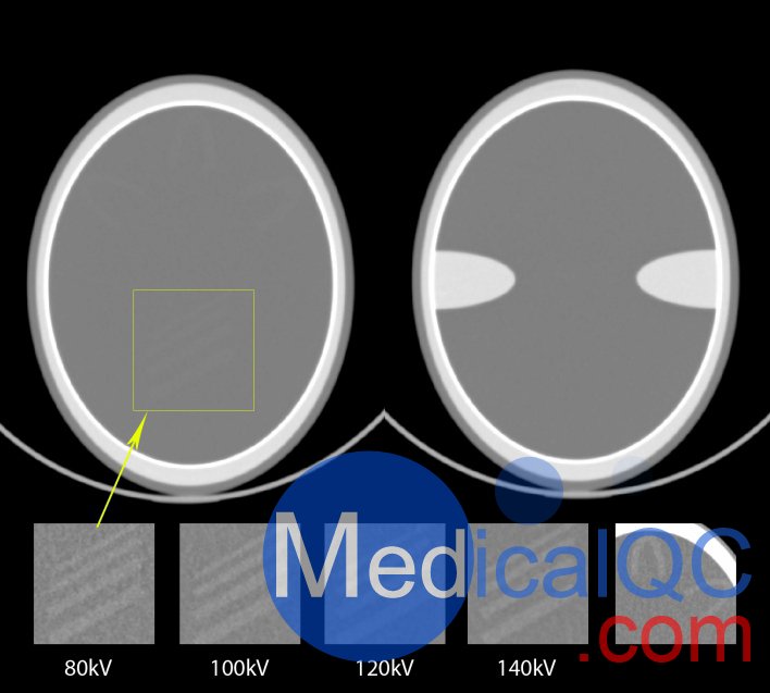 QRM-Cranial-CT-Phantom，顱腦CT模型，Cranial CT Phantom