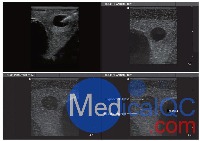 BPT195甲狀腺穿刺模型，BPT195超聲引導(dǎo)穿刺模體影像圖