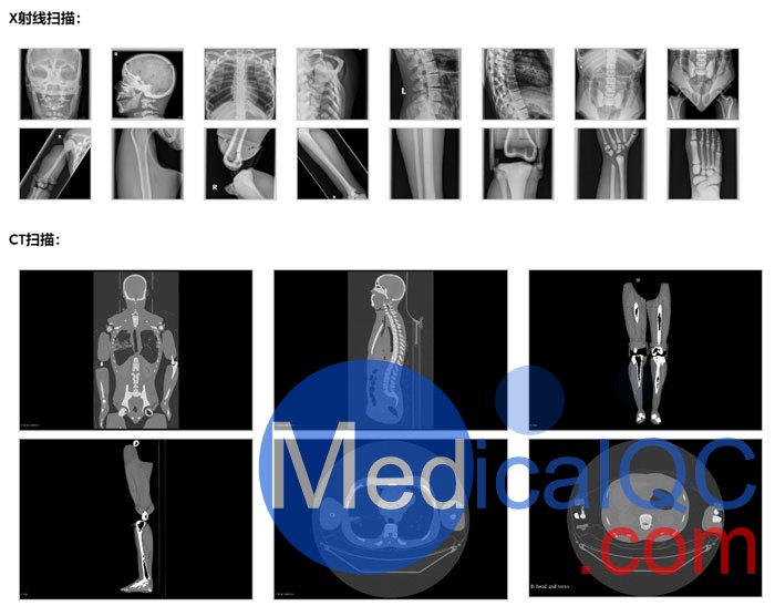 FB-A02成人全身模體,FB-A02全身CT模型成像效果圖